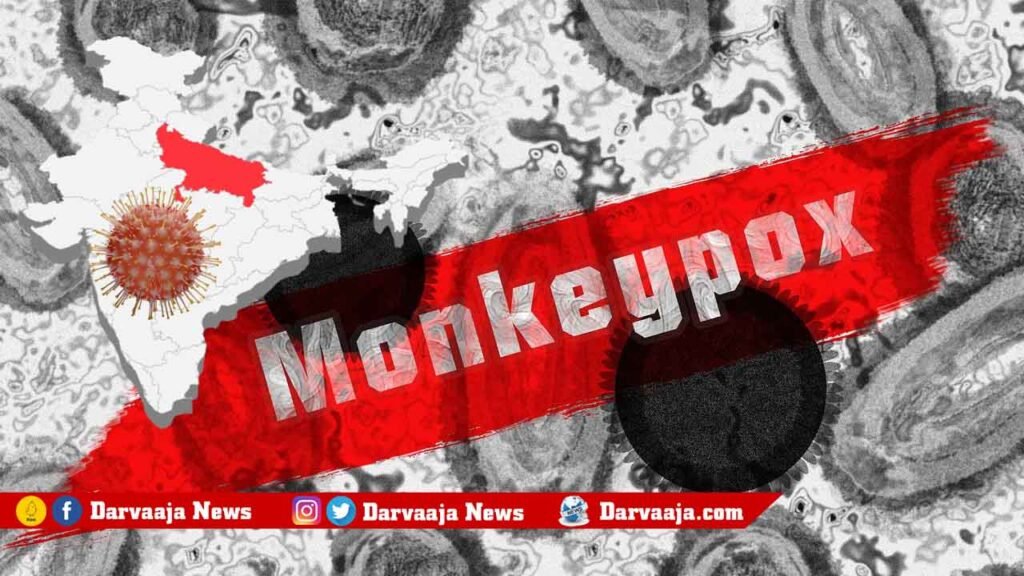 Monkeypox-Ghaziabad-girl-India-World-Health-Organization-US-UKWHO-1024x576 Monkeypox: భార‌త్ లో మంకీపాక్స్ క‌ల‌క‌లం.. ఐదేండ్ల బాలిక‌కు.. !